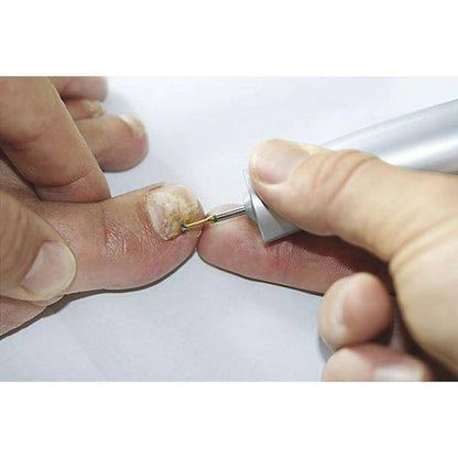 1SXM Tungsten carbide bur - Enucleation of corns - 2.3 mm - My Podologie
