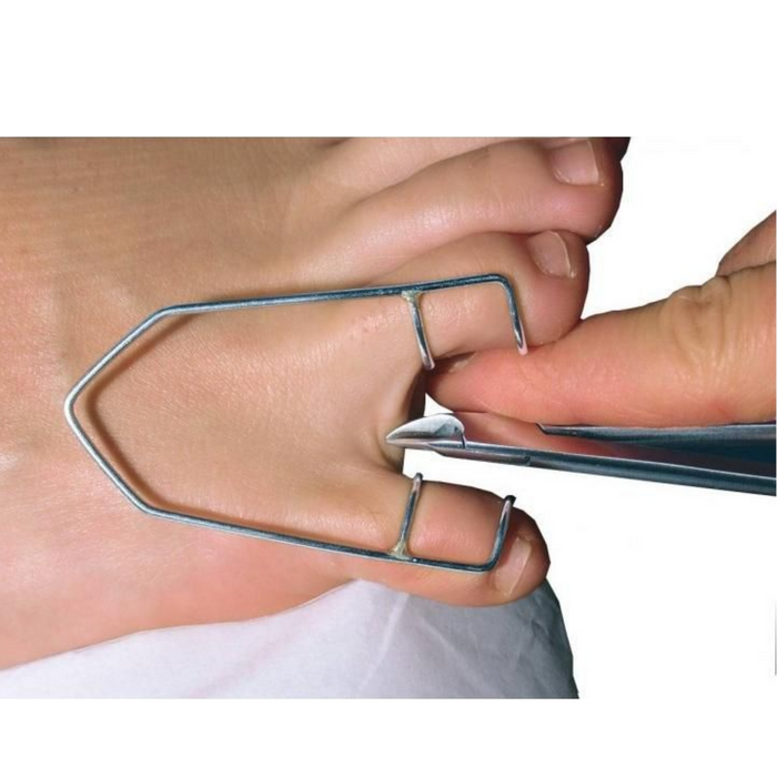 Stainless steel toe spreader - Ruck