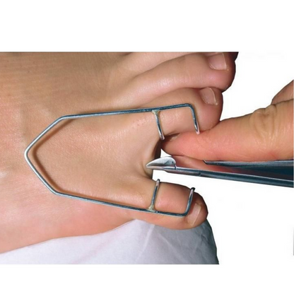 Stainless steel toe spreader - Ruck